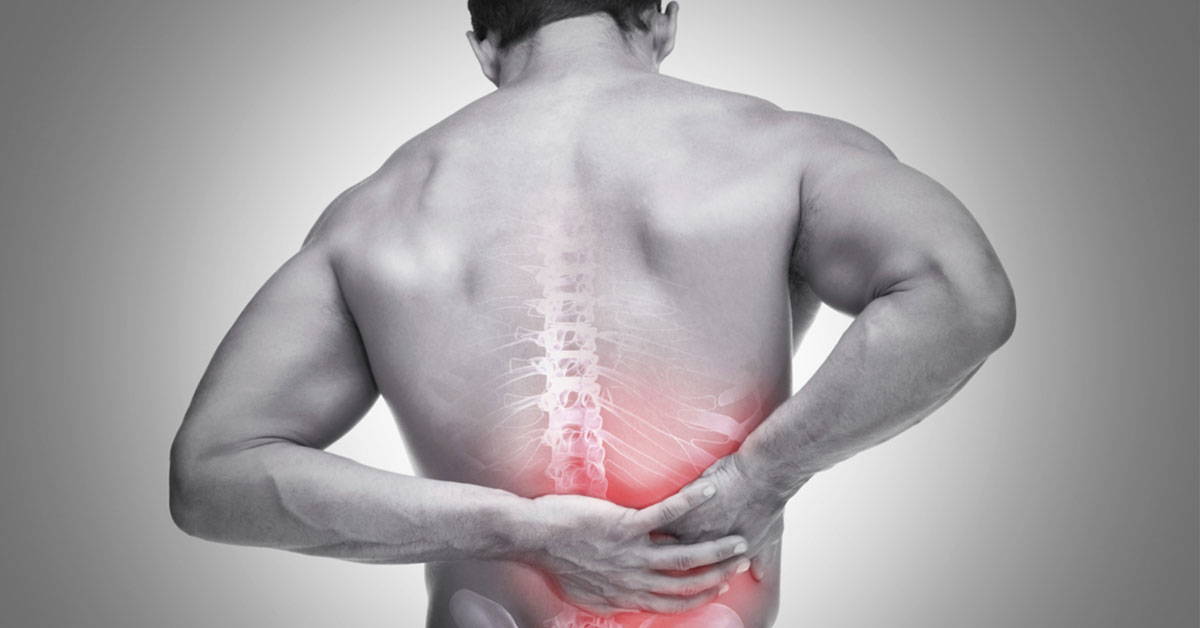 Bel Fıtığı Ameliyatı